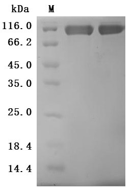 Recombinant Human CUB domain-containing protein 1 (CDCP1), partial (Active) (CSB-MP884474HU)