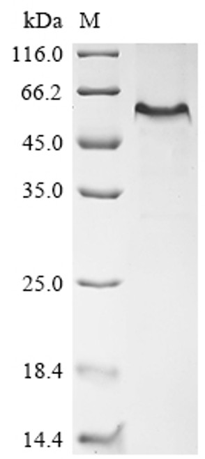 Recombinant Mouse EGF-containing fibulin-like extracellular matrix protein 1 (Efemp1) (CSB-EP007450MO)