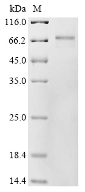 Recombinant Human RNA-binding protein MEX3A (MEX3A) (CSB-EP013740HU)