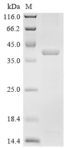 Recombinant Pig Aminopeptidase N (ANPEP), partial (CSB-EP001827PIa0)