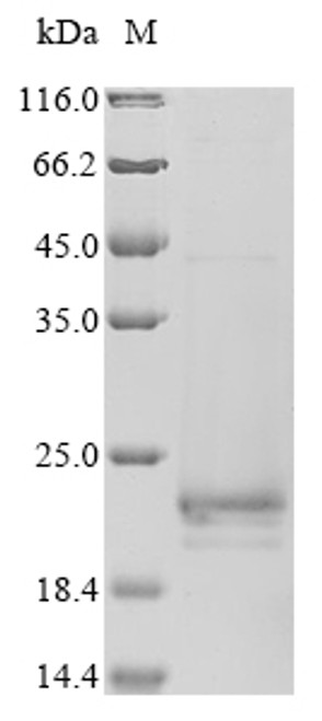 Recombinant Influenza A virus Matrix protein 2 (M), partial (CSB-EP390053ILS1)