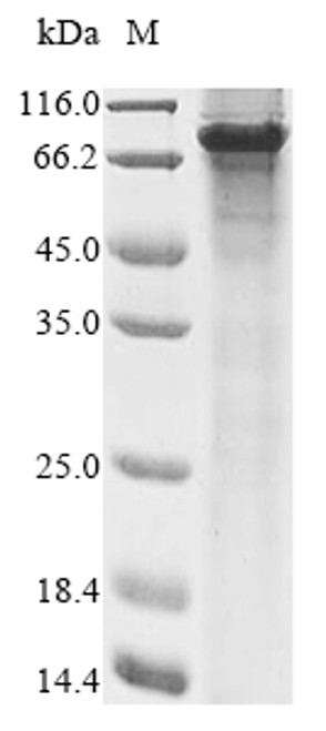 Recombinant Human Forkhead box protein N1 (FOXN1) (CSB-EP008829HU)