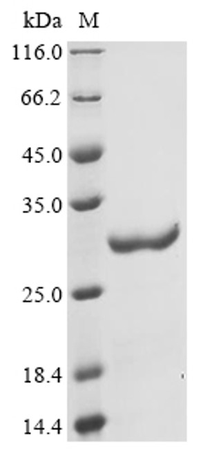 Recombinant Penaeus monodon Myosin light chain, partial (CSB-EP310401ETF)