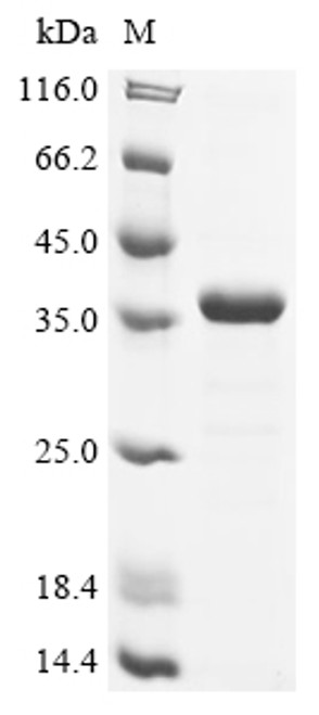 Recombinant Human Transcription initiation factor TFIID subunit 9 (TAF9) (CSB-EP619078HU)