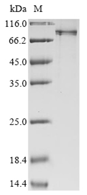 Recombinant Human E3 ubiquitin-protein ligase RNF168 (RNF168) (CSB-EP814236HU)