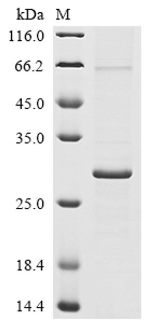 Recombinant Human coronavirus HKU1 Protein I (N) (CSB-EP683656HIU)