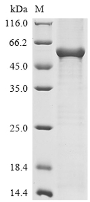 Recombinant Pig Angiopoietin-2 (ANGPT2) (CSB-EP859369PI)