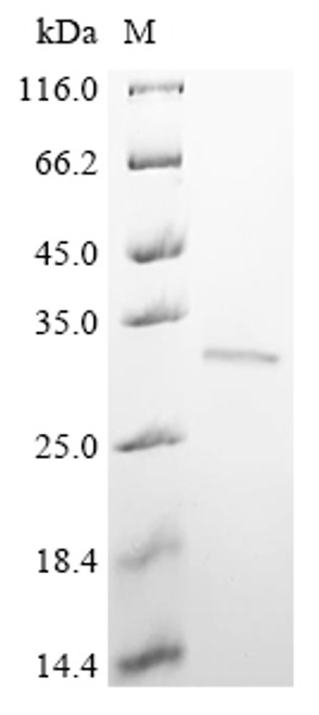 Recombinant Human BRCA1-associated protein (BRAP), partial (CSB-EP4665HU1)