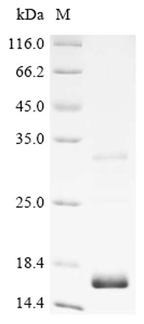 Recombinant Human Vascular endothelial growth factor B (VEGFB), partial (CSB-EP025834HU1a0)