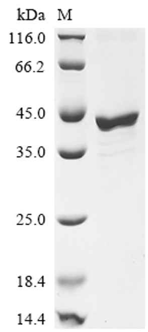 Recombinant Mouse Fos-related antigen 1 (Fosl1) (CSB-EP008792MOb1)