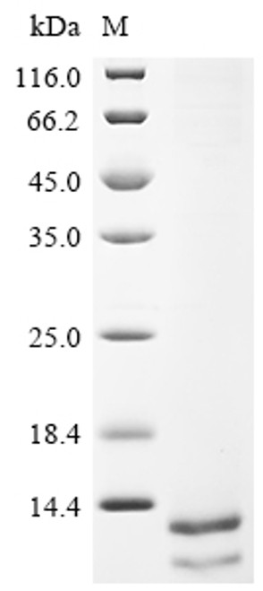Recombinant Human Delta-like protein 3 (DLL3), partial (Active) (CSB-MP882142HU2d7)