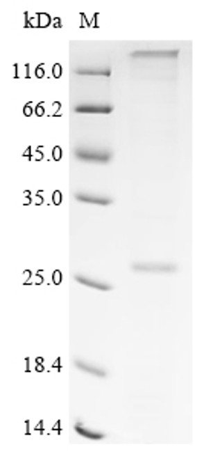 Recombinant Human Taste receptor type 1 member 2 (TAS1R2), partial (CSB-CF840577HU1)