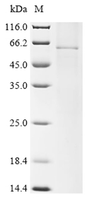Recombinant Human parainfluenza 1 virus Hemagglutinin-neuraminidase (HN) (CSB-CF323673HOY)
