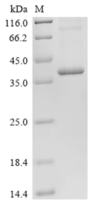 Recombinant Human STEAP1 protein (STEAP1) (CSB-CF890691HUd7)