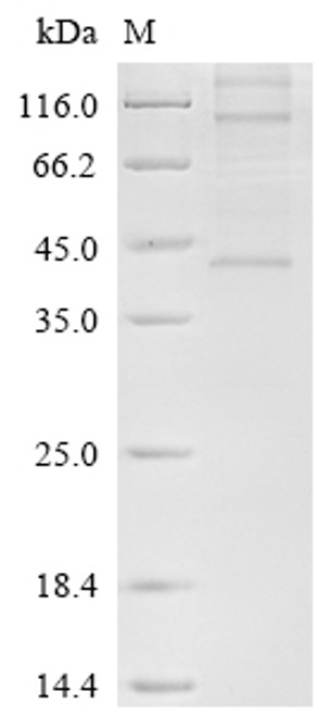 Recombinant Human Chemerin-like receptor 1 (CMKLR1) (CSB-CF005614HUd7)