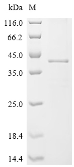 Recombinant Eisenia fetida Lysenin (CSB-CF515723EJVb0)