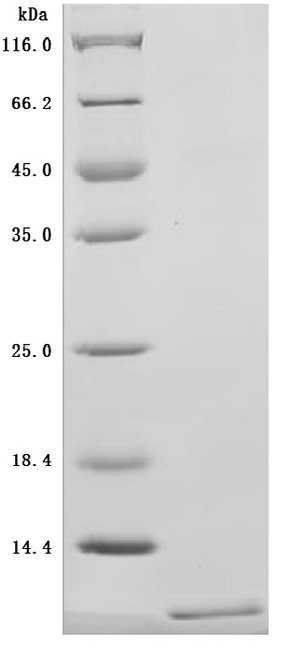 Recombinant Human CD81 antigen (CD81), partial (Active) (CSB-MP004960HUd7)