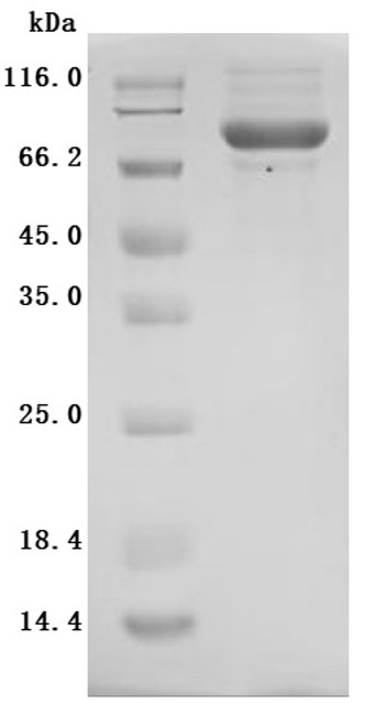 Recombinant Mouse Cytotoxic and regulatory T-cell molecule (Crtam), partial (Active) (CSB-MP614820MO)