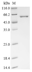 Recombinant Vaccinia virus Serine/threonine-protein kinase 2 (OPG054) (CSB-EP321888VAA)