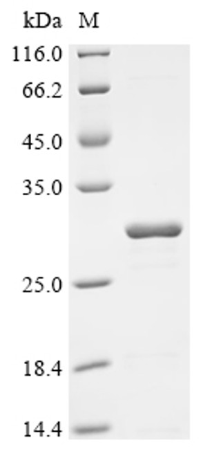 Recombinant Rickettsia rickettsii Chaperonin GroEL (groEL), partial (CSB-EP422667RNC)