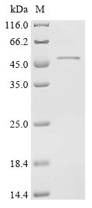 Recombinant Bovine Paraneoplastic antigen Ma1 homolog (PNMA1) (CSB-EP018266BO)