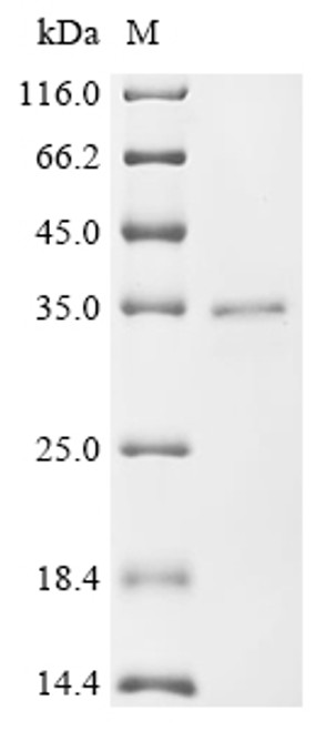 Recombinant Human herpesvirus 2 Envelope glycoprotein L (gL) (CSB-EP328787HJXc7)