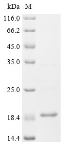 Recombinant Human herpesvirus 2 Protein UL20 (UL20), partial (CSB-EP310461HJX1)