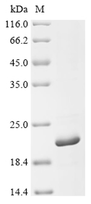 Recombinant Human herpesvirus 2 Small capsomere-interacting protein (SCP) (CSB-EP309704HJX)