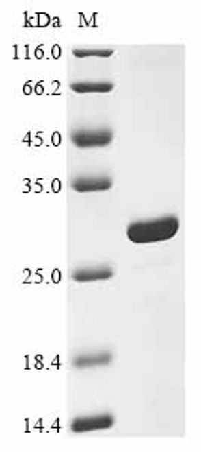 Recombinant Human NAD-dependent protein deacetylase sirtuin-3, mitochondrial (SIRT3), partial (CSB-EP882102HU1)