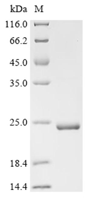 Recombinant Human Microtubule-associated protein tau (MAPT), partial (CSB-EP013481HU(F1))
