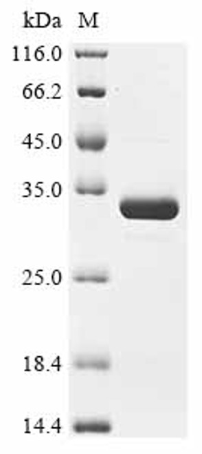 Recombinant Bordetella parapertussis Pertussis toxin subunit 1 homolog (ptxA) (CSB-EP749747BIK)