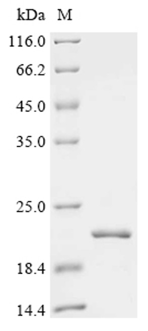 Recombinant Human C5a anaphylatoxin chemotactic receptor (C5AR1), partial (CSB-EP003996HU1)