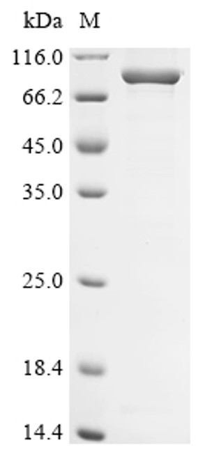 Recombinant Human Delta-1-pyrroline-5-carboxylate synthase (ALDH18A1) (CSB-EP001564HUe1)