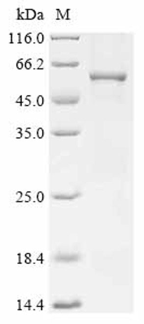 Recombinant Rat Muscle, skeletal receptor tyrosine protein kinase (Musk), partial (CSB-EP733845RA)
