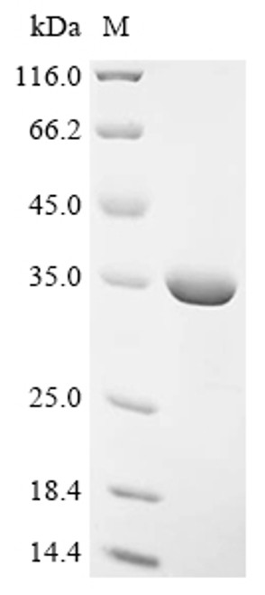 Recombinant Mouse Lys-63-specific deubiquitinase BRCC36 (Brcc3) (CSB-EP002798MO)