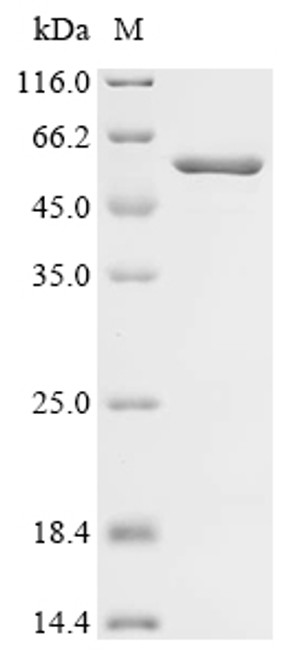Recombinant Human C5a anaphylatoxin chemotactic receptor (C5AR1), partial, Biotinylated (CSB-EP003996HU1-B)