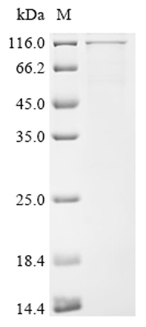 Recombinant Human Ubiquitin carboxyl-terminal hydrolase 1 (USP1) (CSB-EP025695HUa0)