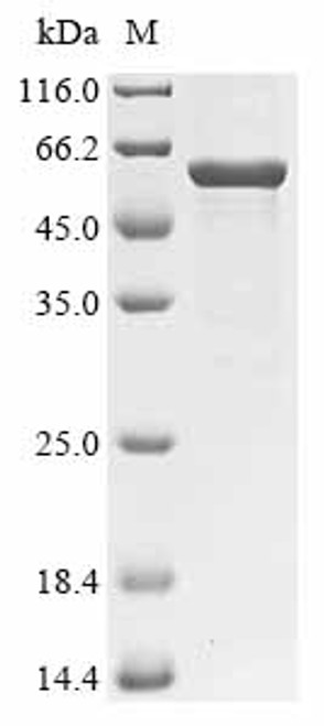 Recombinant Francisella tularensis subsp. tularensis LPS-assembly protein lptD (lptD), partial (CSB-EP689721FAAA)