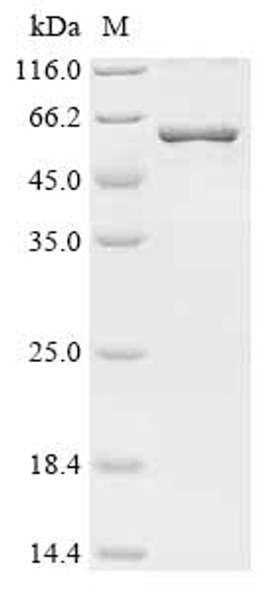 Recombinant Human Matrix metalloproteinase-25 (MMP25) (CSB-EP885679HUb1)