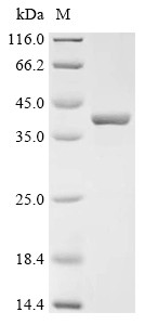 Recombinant Coxiella burnetii Bis (5’-nucleosyl)-tetraphosphatase, symmetrical (apaH) (CSB-EP429264DXO)
