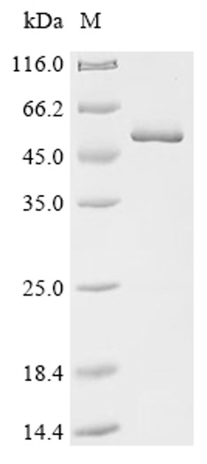 Recombinant Chicken Serpin H1 (SERPINH1) (CSB-EP021087CH)