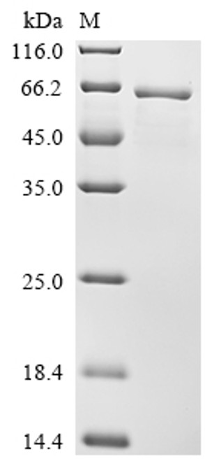 Recombinant Human Ryanodine receptor 1 (RYR1), partial (CSB-EP020619HUb0)