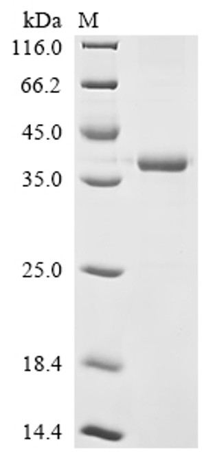 Recombinant Human Unconventional myosin-X (MYO10), partial (CSB-EP884628HU)