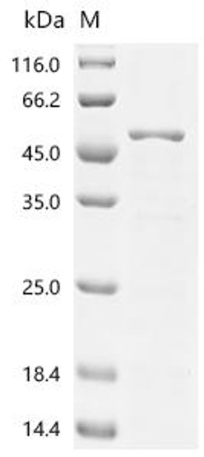 Recombinant Human Paraneoplastic antigen Ma2 (PNMA2), partial (CSB-EP018267HUc7)