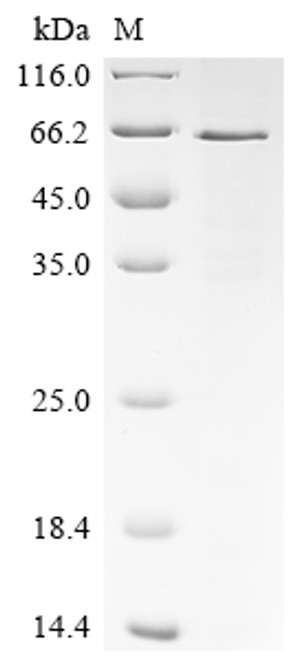 Recombinant Human Cellular tumor antigen p53 (TP53) (Y220C) (CSB-EP024077HU(M1))