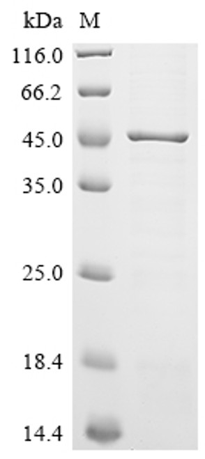 Recombinant Rickettsia conorii Outer membrane protein B (ompB), partial (CSB-EP867765RMS1)