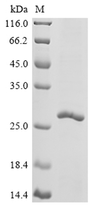 Recombinant Chapare mammarenavirus Pre-glycoprotein polyprotein GP complex (GPC), partial (CSB-EP463893DRQ1)
