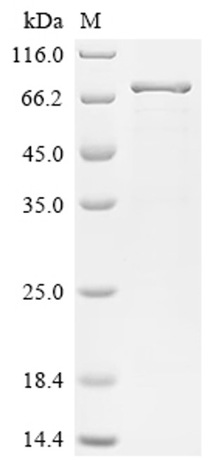 Recombinant Human Drebrin-like protein (DBNL) (CSB-EP892128HUa2)