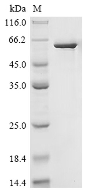 Recombinant Puumala virus Nucleoprotein (N) (CSB-EP325677PXF)