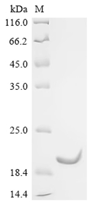 Recombinant Mouse Spectrin beta chain, non-erythrocytic 1 (Sptbn1), partial (CSB-EP733819MO)